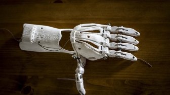 OpenBionics: Affordable Prosthetics