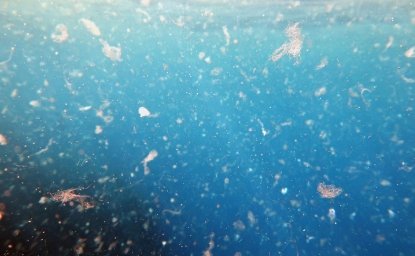 Microplastics in the Ocean